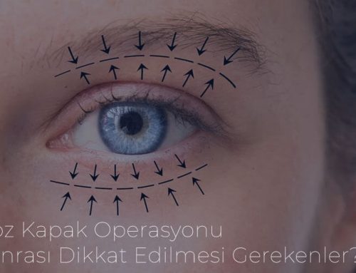 Göz Kapak Opreasyonu Sonrası Dikkat Edilmesi Gerekenler?