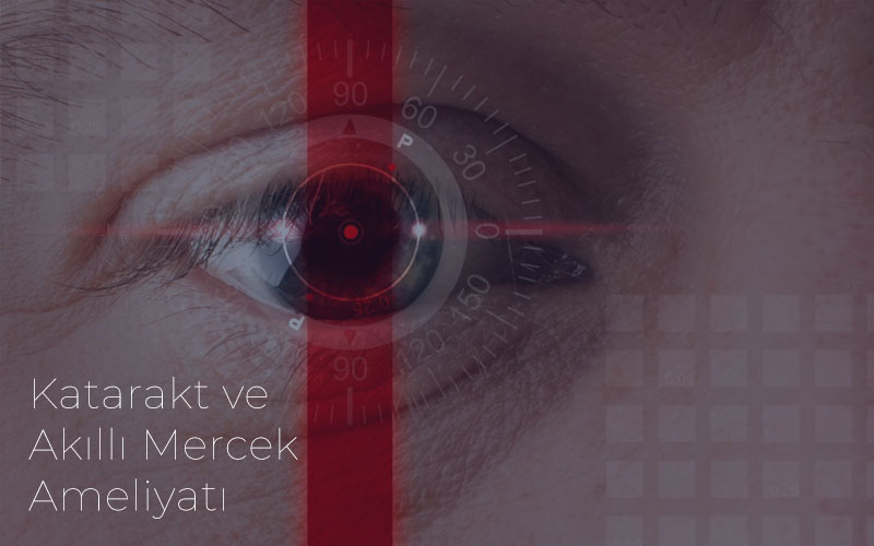 katarakt-ve-akilli-mercek-ameliyati-özlem-beyazyildiz-blog-800×500