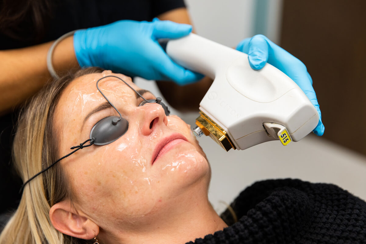 BBL Hero Lazer Öncesi Dikkat Edilmesi Gerekenler