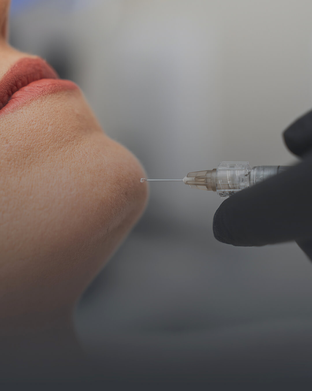 Samsun Çene Ucu Dolgusu