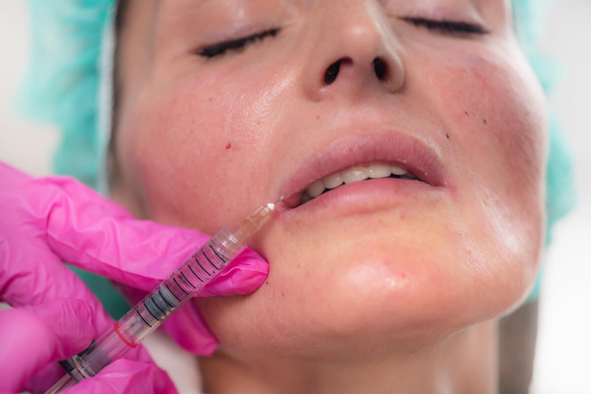 Dudak Dolgusu Fiyatları 2026