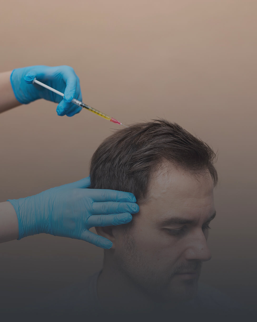 Samsun Eksozom Tedavisi