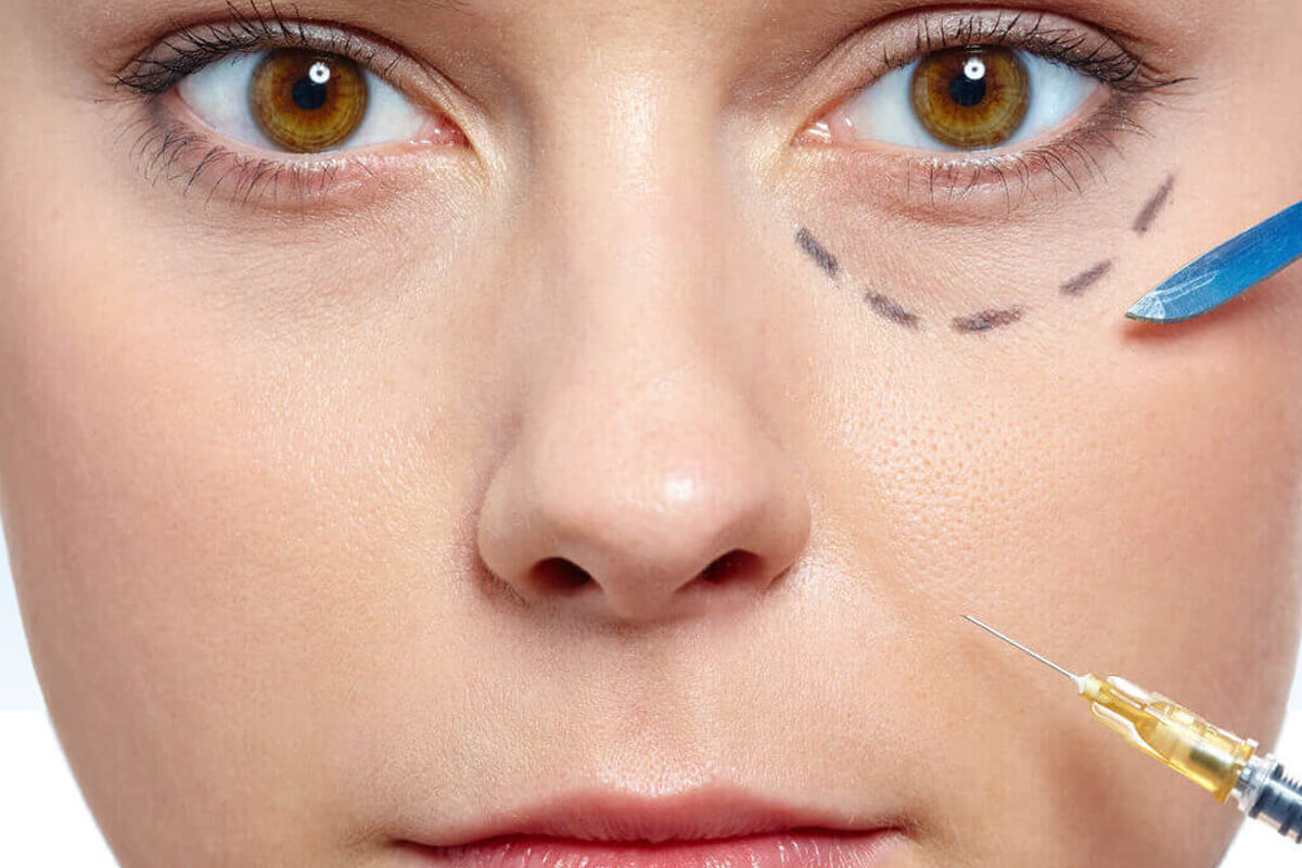 Göz Altı Işık Dolgusu Etkisi