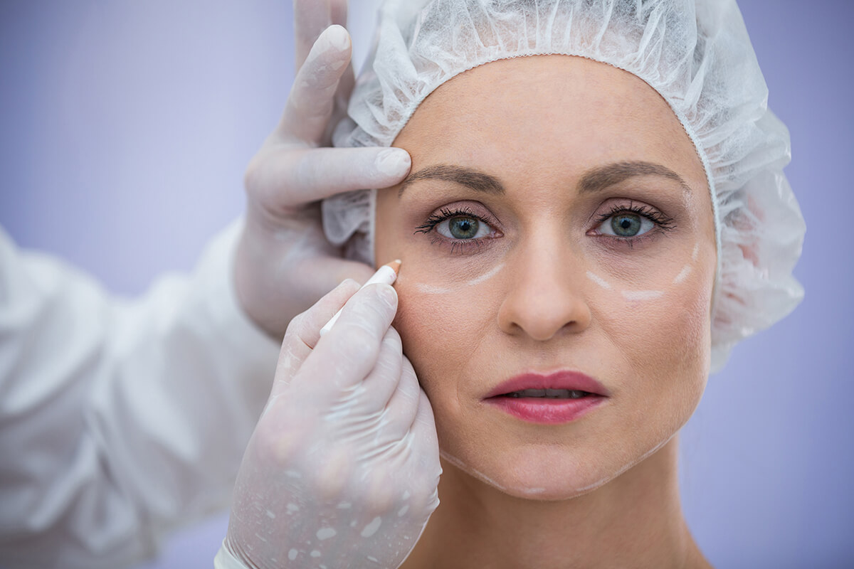 Göz Çevresi Mezoterapi Uygulaması Öncesi Dikkat Edilmesi Gerekenler