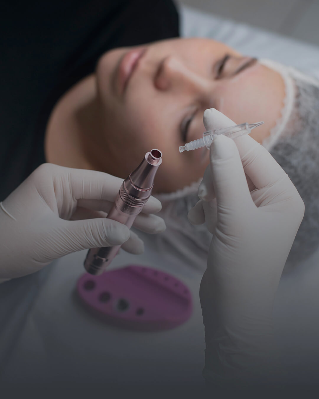 Samsun Göz Çevresi Mezoterapisi