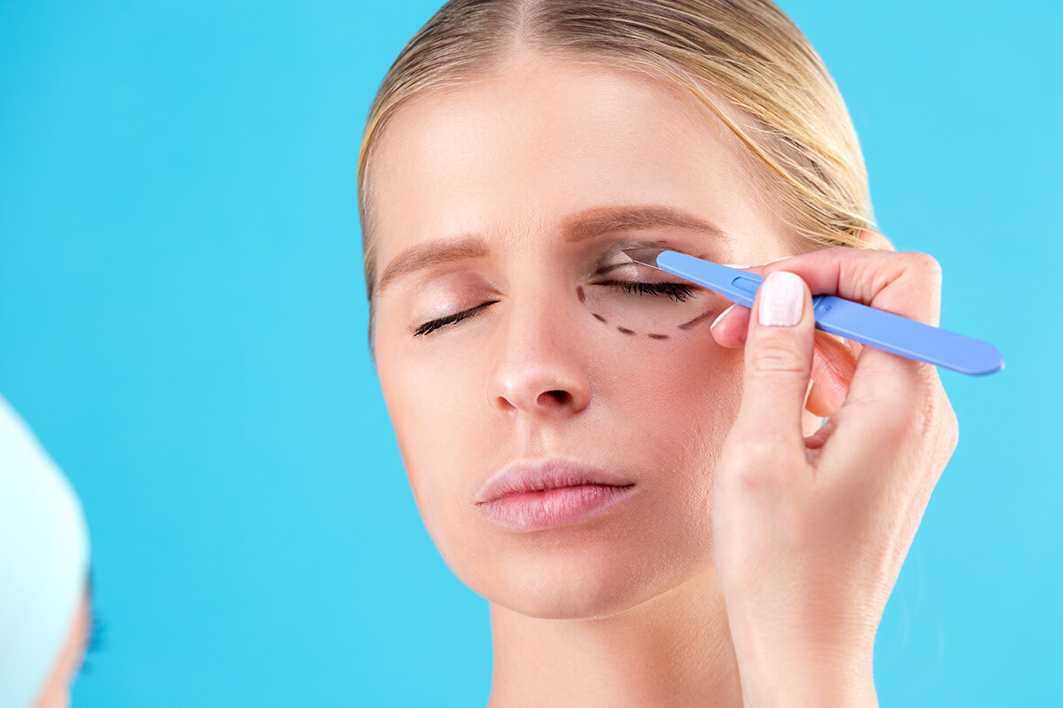 Samsun Göz Kapağı Estetiği (Blefaroplasti)