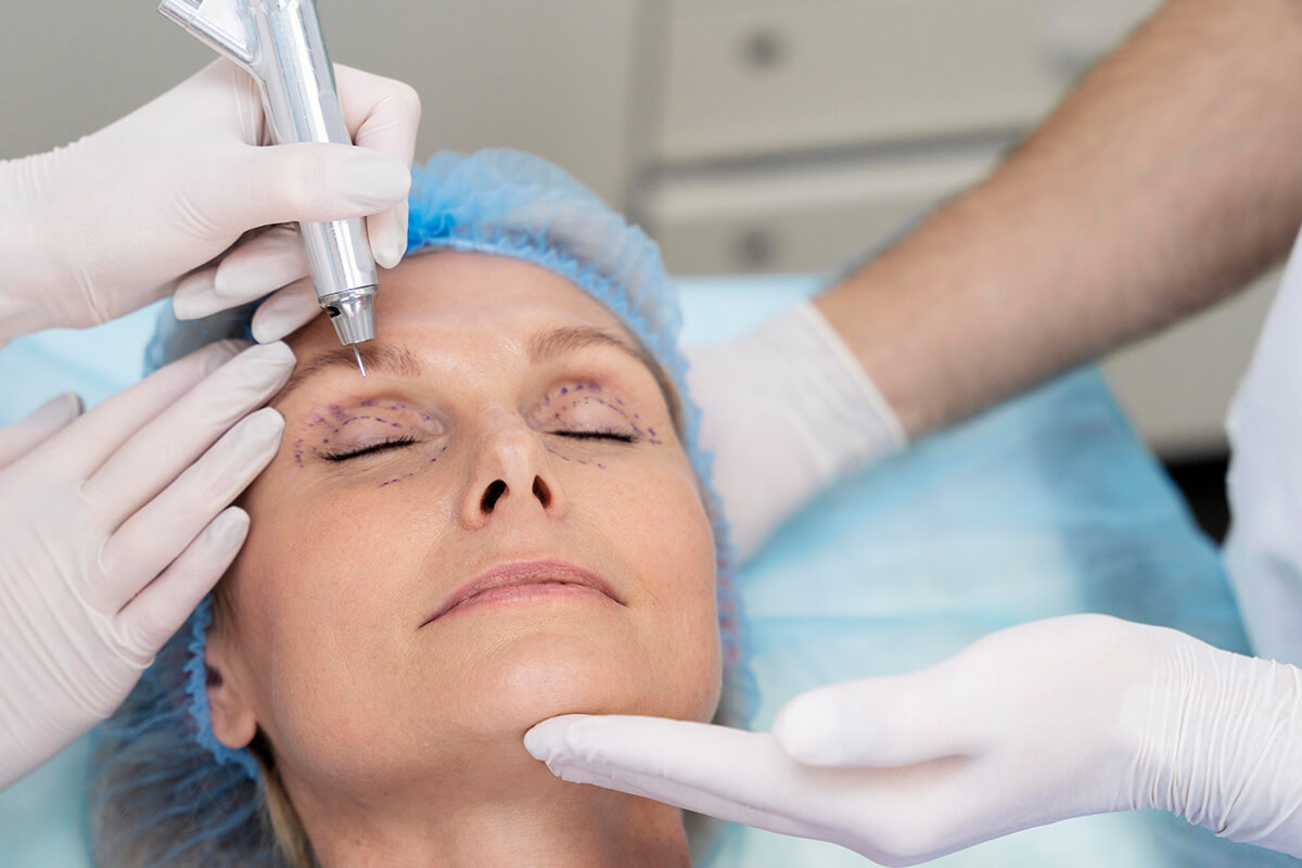 Göz Kapağı Estetiği (Blefaroplasti) İyileşme Süreci