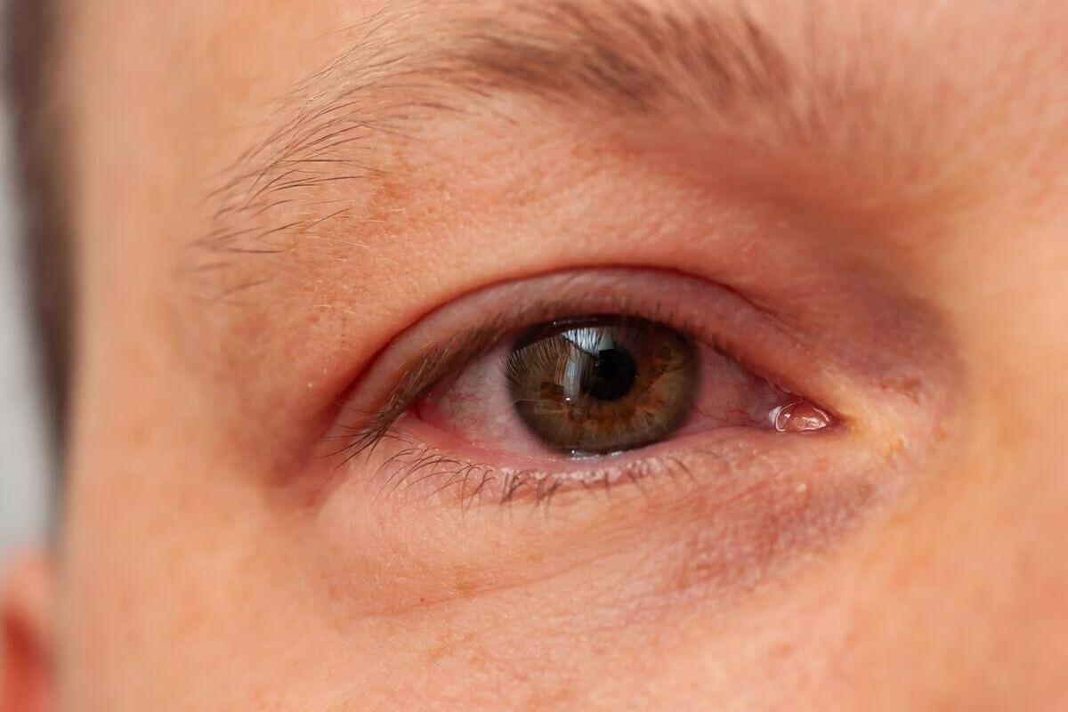 Göz Kuruluğu Tedavisi Fiyatları 2026