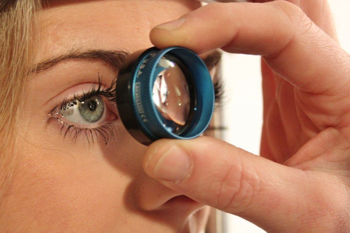 Göz Tansiyonu (Glokom) Tedavi Süreci