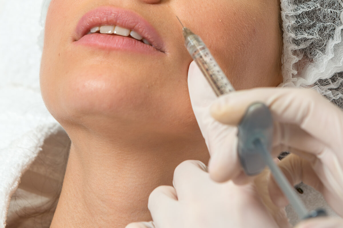 Kimler Nazolabial Dolgu Yaptırabilir?