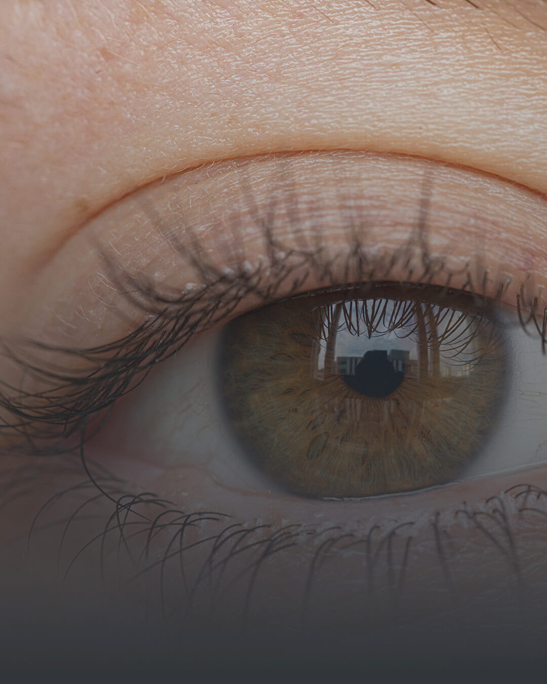 Kornea Hastalıkları