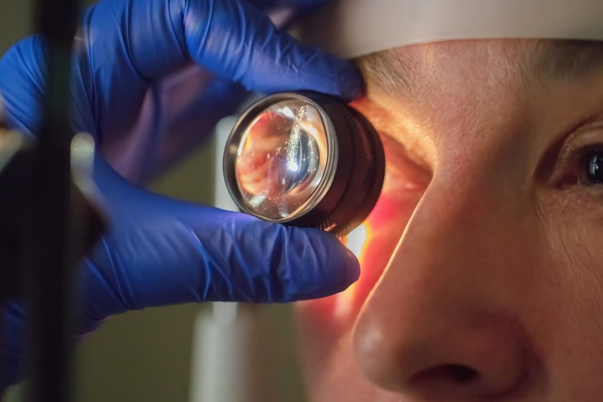 Kornea Hastalıkları Belirtileri