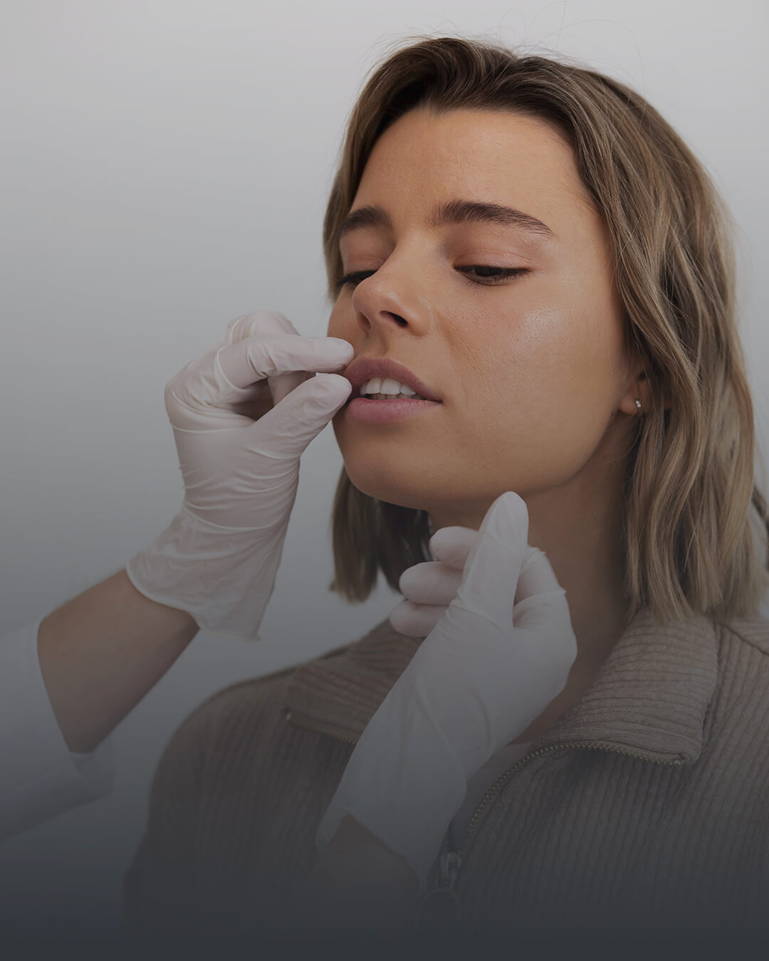 Samsun Nasolabial Dolgu