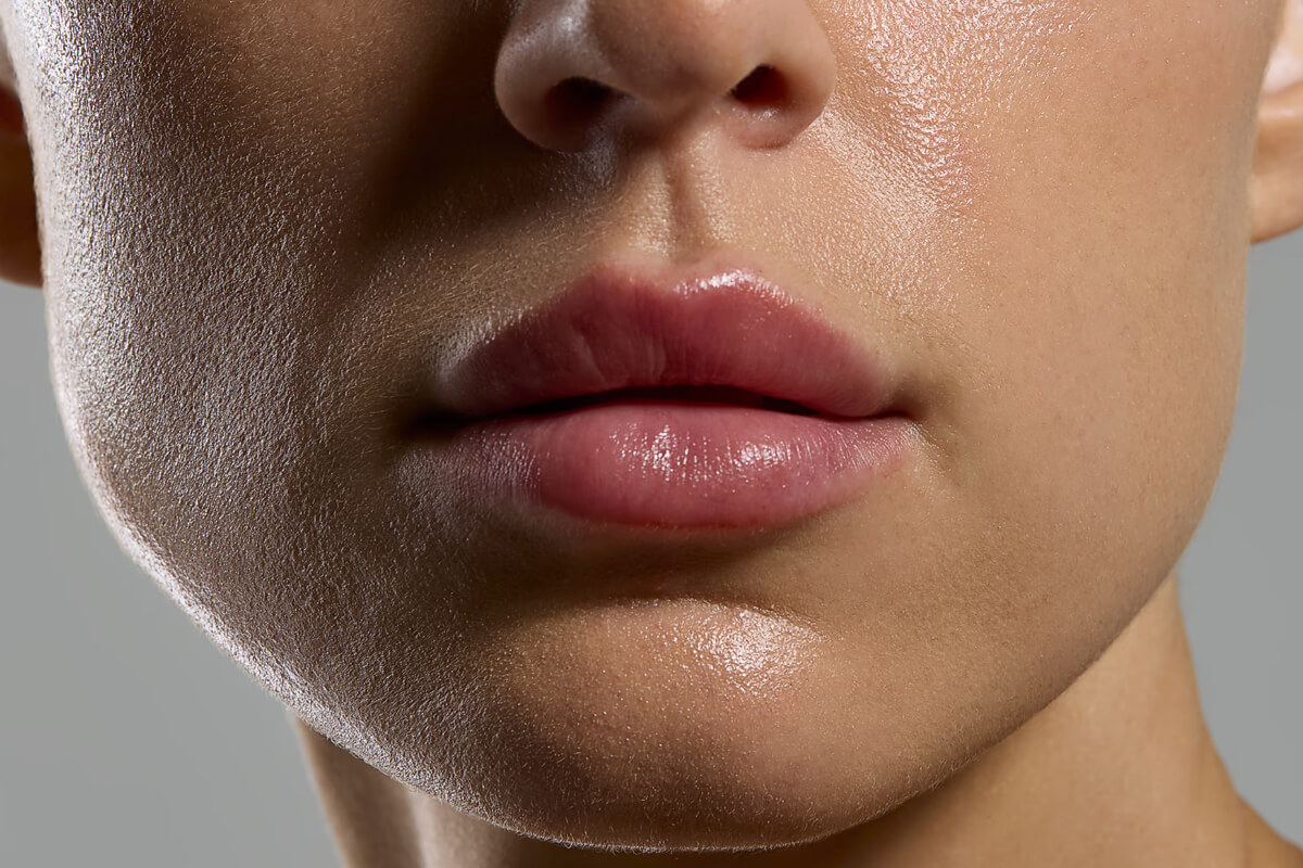 Nazolabial Dolgu Yaptırırken Neye Dikkat Etmek Gerekir?