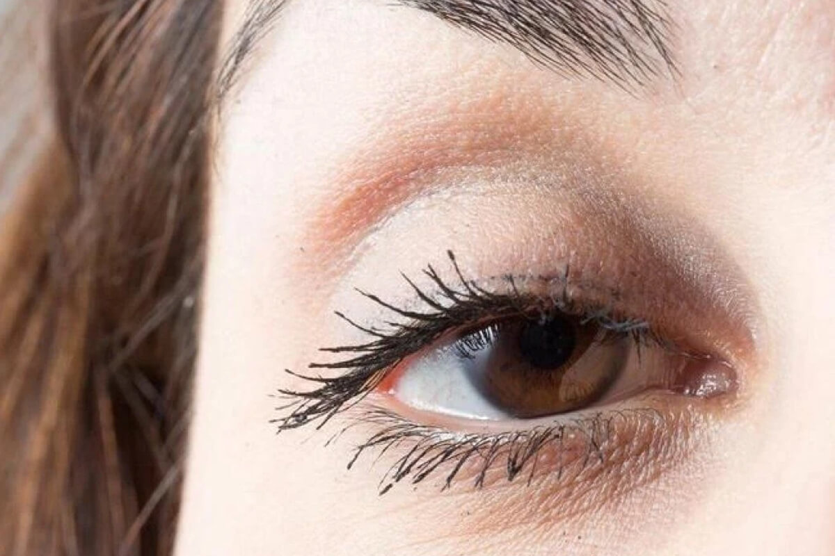 Pitozis (Göz Kapağı Düşüklüğü) Tedavisi Sonrası Nelere Dikkat Edilmelidir?