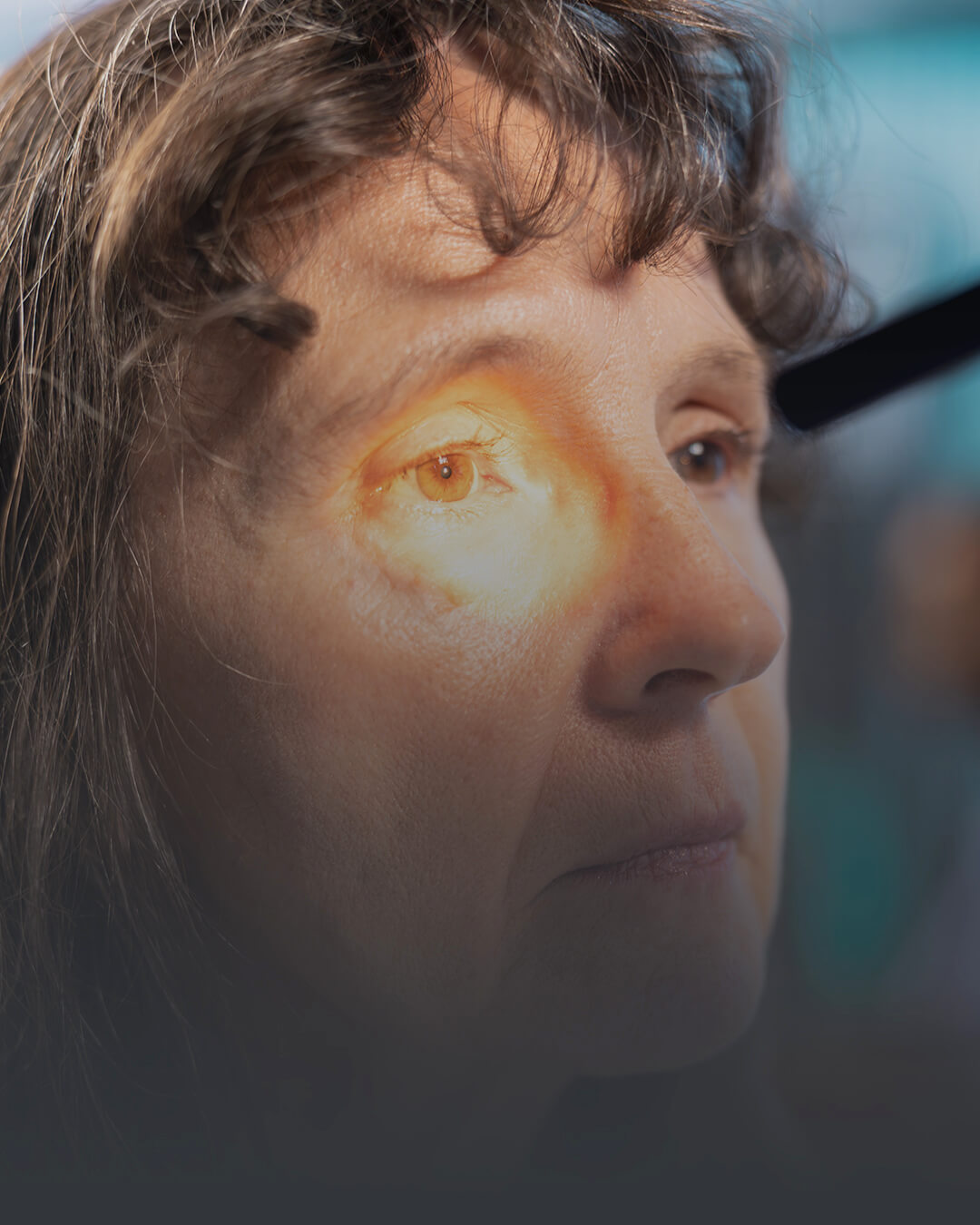 Retina Hastalıkları