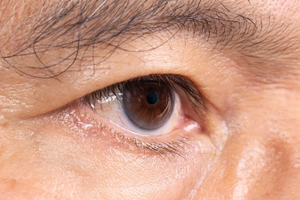 Retina Hastalıklarında Risk Faktörleri