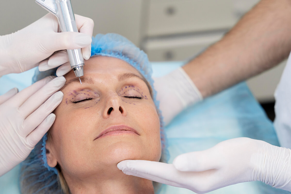 Samsun Ektropion (Göz Kapaklarının Dışa Dönmesi) Tedavisi