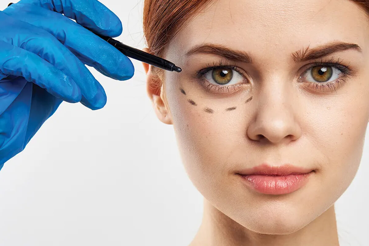 Samsun Göz Çevresi Mezoterapisi