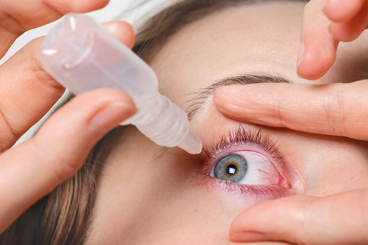 Samsun Göz Kuruluğu Tedavisi