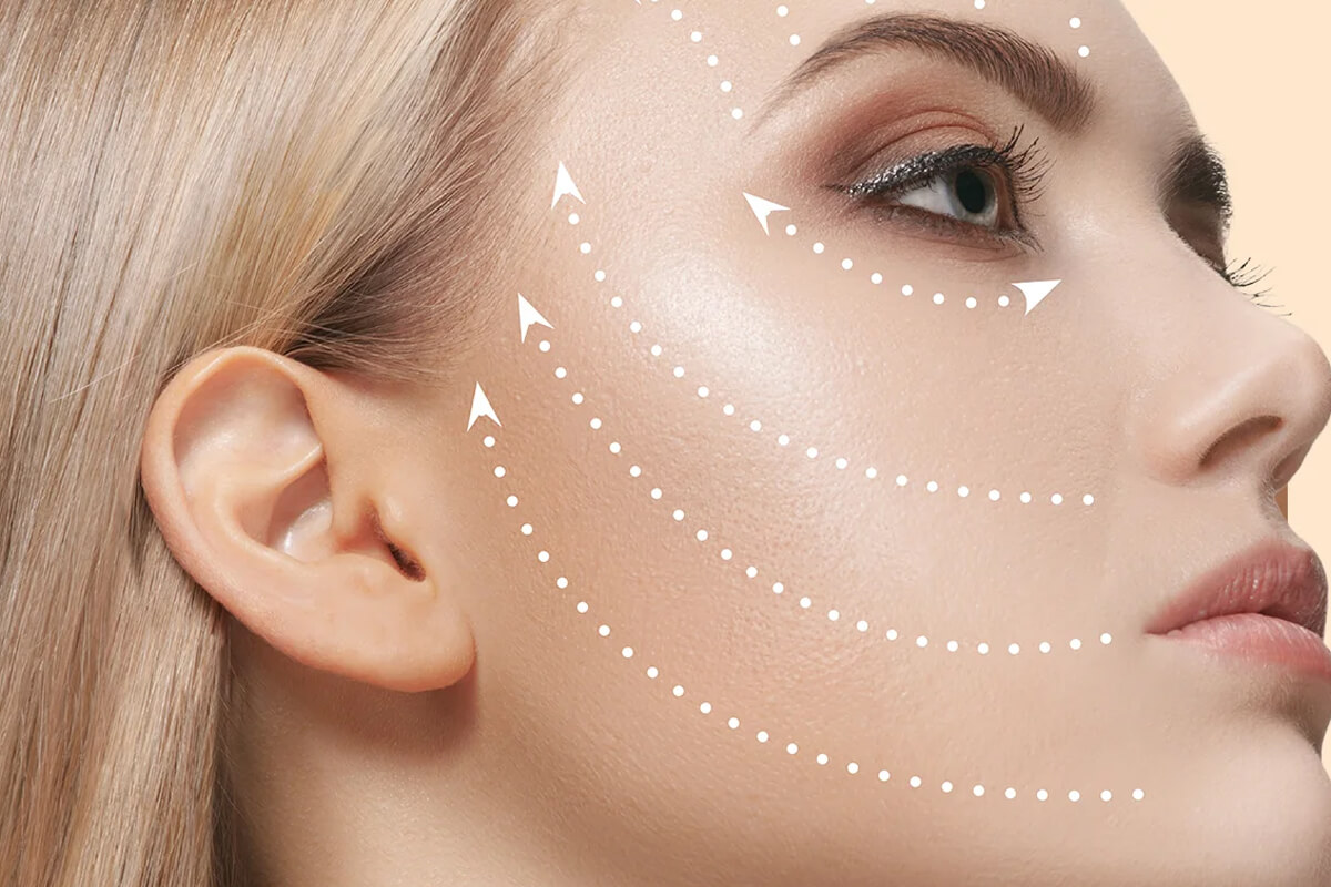 Samsun Sıvı Yüz Germe (Liquid Facelift)