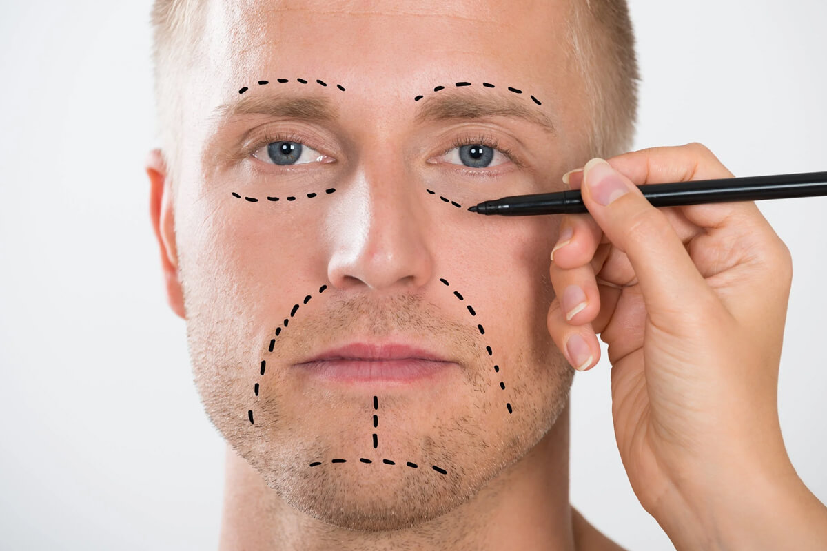 Sıvı Yüz Germe Nasıl Yapılır?