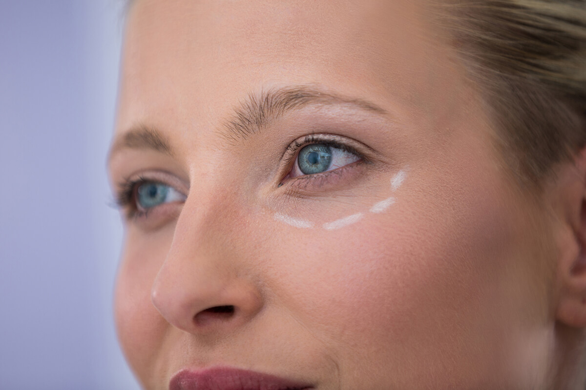 Göz Altı Torbaları Ameliyatı Nasıl Yapılır?