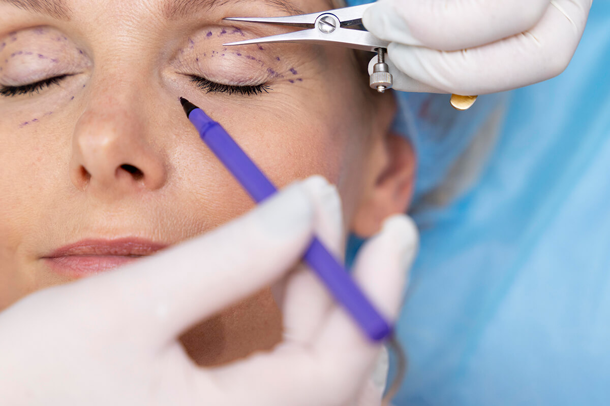 Kaşlar Düşükken Sadece Göz Kapağı Ameliyatı Yapılırsa Ne Olur?