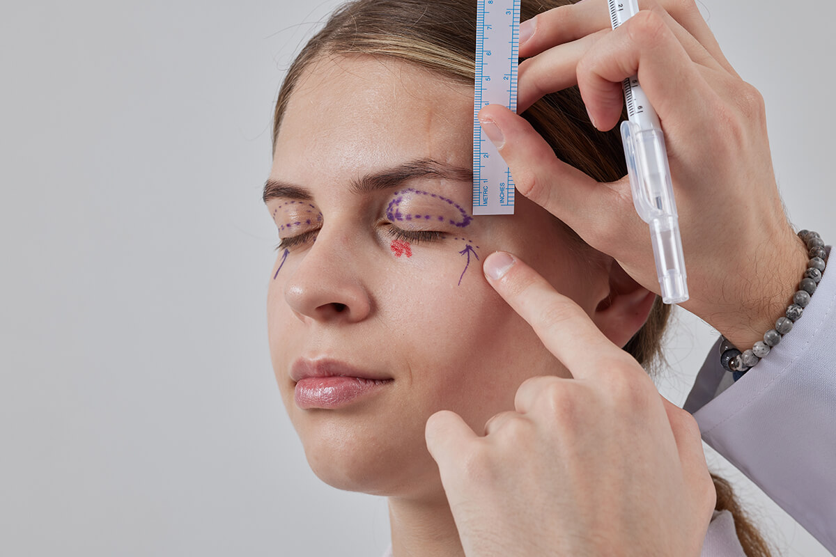 Üst Göz Kapağı Estetiği Yaptırmadan Önce Dikkat Edilmesi Gerekenler